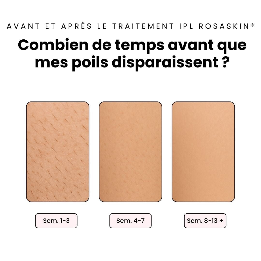 Kit complet (gant, crème, IPL, trousse) - ROSASKIN