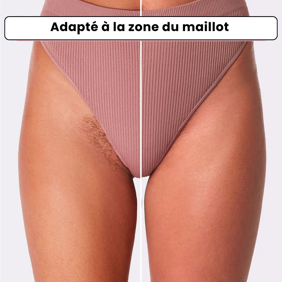 Épilateur à lumière pulsée IPL RosaSkin®