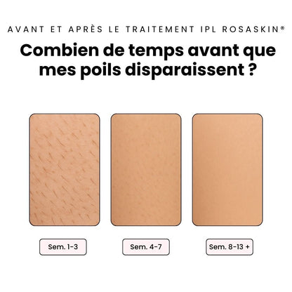 Kit complet (gant, crème, IPL, trousse) - ROSASKIN